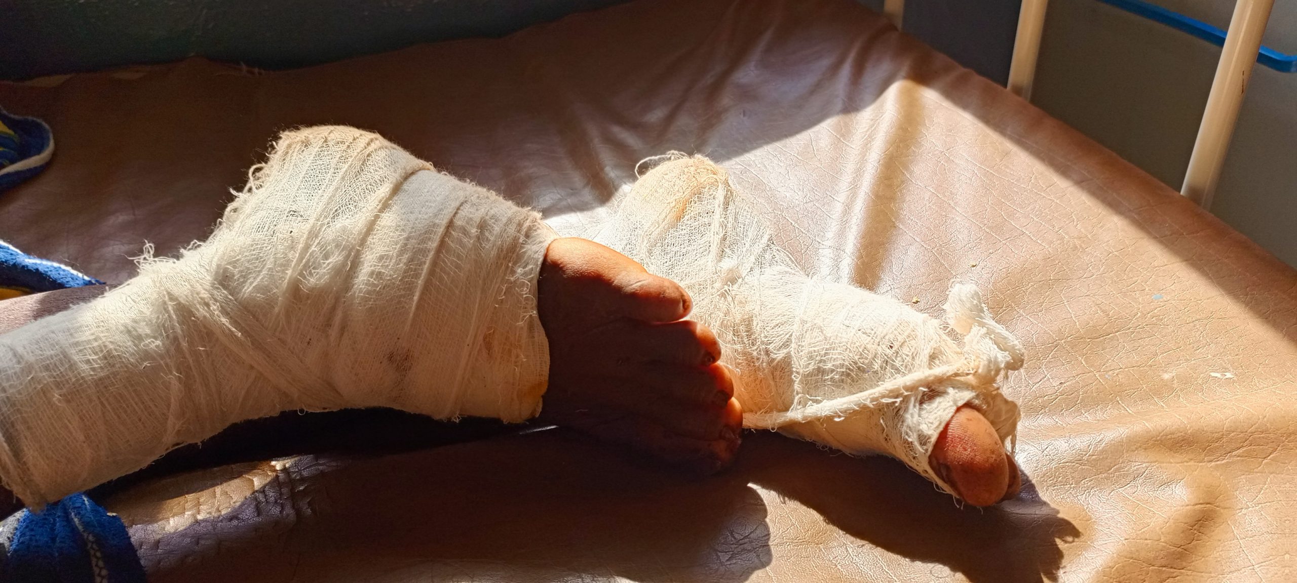 Tougué : un homme grièvement blessé par un léopard à Sambaya